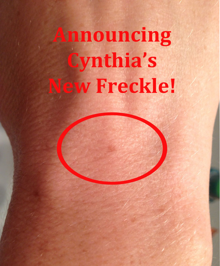 New Freckle, New Freckle Suppliers and Manufacturers at ...